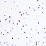 PEG3 Antibody in Immunohistochemistry (Paraffin) (IHC (P))