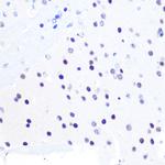 PEG3 Polyclonal Antibody
