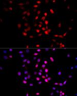 AMPK alpha-1,2 Polyclonal Antibody