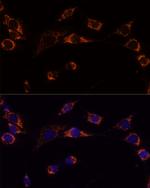 PRDX3 Polyclonal Antibody