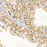 PIWIL4 Polyclonal Antibody