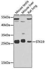 STK19 Antibody in Western Blot (WB)