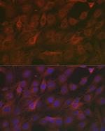 SOD2 (MnSOD) Antibody in Immunocytochemistry (ICC/IF)