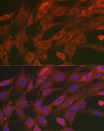 SOD2 (MnSOD) Antibody in Immunocytochemistry (ICC/IF)