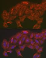 SOD2 (MnSOD) Antibody in Immunocytochemistry (ICC/IF)