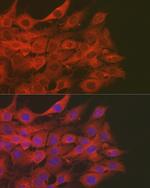 SOD2 (MnSOD) Antibody in Immunocytochemistry (ICC/IF)