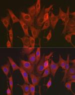 SOD2 (MnSOD) Polyclonal Antibody