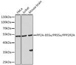 PPP2R2A Polyclonal Antibody