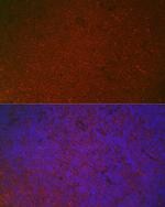 FCGR2A Polyclonal Antibody