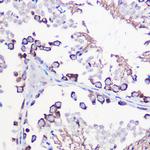 DAZL Polyclonal Antibody