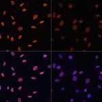 H4K12ac Polyclonal Antibody