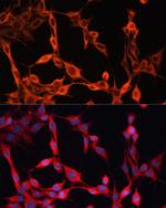 SLC25A23 Polyclonal Antibody