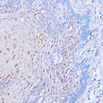 NME6 Polyclonal Antibody
