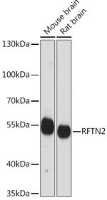 RFTN2 Antibody in Western Blot (WB)
