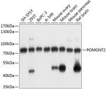 POMGNT2 Polyclonal Antibody