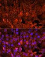 CIS Polyclonal Antibody