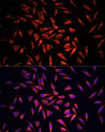 GSDMC Polyclonal Antibody