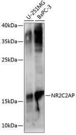 ANKHD1 Antibody in Western Blot (WB)