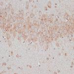 TMX Antibody in Immunohistochemistry (Paraffin) (IHC (P))