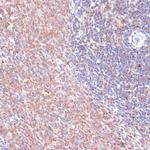 TMX Antibody in Immunohistochemistry (Paraffin) (IHC (P))