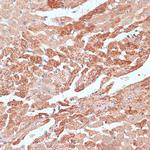 TMX Antibody in Immunohistochemistry (Paraffin) (IHC (P))