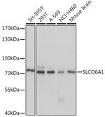 SLCO6A1 Polyclonal Antibody
