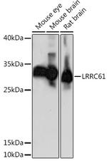 LRRC61 Polyclonal Antibody