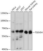TSEN54 Polyclonal Antibody