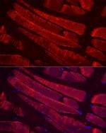 Myosin 4 Polyclonal Antibody