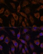 SUCLG1 Polyclonal Antibody