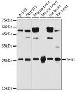 TWIST1 Polyclonal Antibody