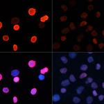 H2BK5ac Antibody in Immunocytochemistry (ICC/IF)