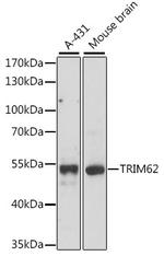 TRIM62 Antibody in Western Blot (WB)