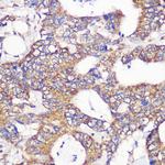 GCP6 Polyclonal Antibody