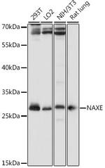 APOA1BP Polyclonal Antibody