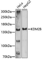 FBXL10 Polyclonal Antibody