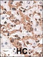 KChIP3 Antibody in Immunohistochemistry (Paraffin) (IHC (P))