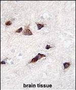 KChIP3 Antibody in Immunohistochemistry (Paraffin) (IHC (P))