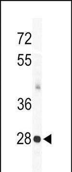 KChIP3 Antibody in Western Blot (WB)