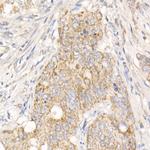 PGAM5 Antibody in Immunohistochemistry (Paraffin) (IHC (P))