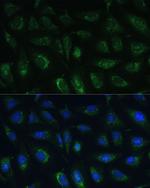 RAPGEF1 Polyclonal Antibody
