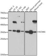 KCNK6 Antibody in Western Blot (WB)
