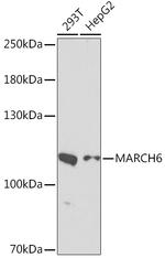 TEB4 Antibody in Western Blot (WB)