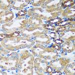 FBXO21 Antibody in Immunohistochemistry (Paraffin) (IHC (P))