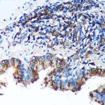 FBXO21 Antibody in Immunohistochemistry (Paraffin) (IHC (P))