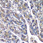 FBXO21 Antibody in Immunohistochemistry (Paraffin) (IHC (P))