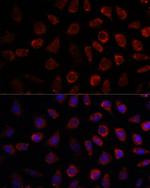 PDE11A Polyclonal Antibody