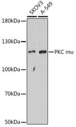 PKC mu Polyclonal Antibody