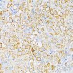 USP33 Antibody in Immunohistochemistry (Paraffin) (IHC (P))