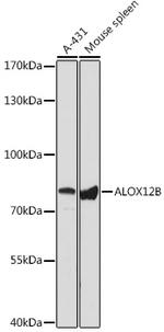 ALOX12B Polyclonal Antibody